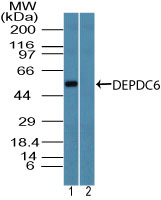 DEPTOR / DEPDC6 Antibody - Western blot of DEPOR/DEPDC6 in human lung lysate in the 1) absence and 2) presence of immunizing peptide using Polyclonal Antibody to DEPOR/DEPDC6 at 3 ug/ml. Goat anti-rabbit Ig HRP secondary antibody, and PicoTect ECL substrate solution, were used for this test.