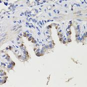 DEPTOR / DEPDC6 Antibody - Immunohistochemistry of paraffin-embedded Rat bronchus using DEPDC6 Polyclonal Antibody at dilution of 1:200 (40x lens).