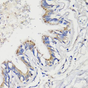 DEPTOR / DEPDC6 Antibody - Immunohistochemistry of paraffin-embedded Human lung using DEPDC6 Polyclonal Antibody at dilution of 1:200 (40x lens).