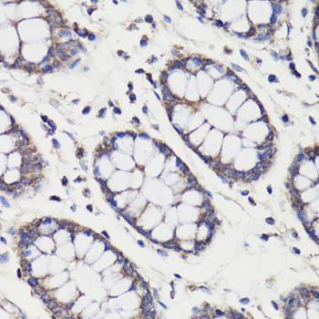 DEPTOR / DEPDC6 Antibody - Immunohistochemistry of paraffin-embedded Human colon using DEPDC6 Polyclonal Antibody at dilution of 1:200 (40x lens).