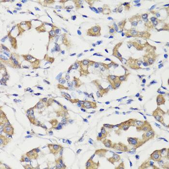 DEPTOR / DEPDC6 Antibody - Immunohistochemistry of paraffin-embedded Human stomach using DEPDC6 Polyclonal Antibody at dilution of 1:200 (40x lens).