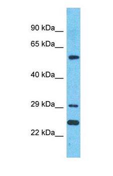 DERL1 / Derlin 1 Antibody - Western blot of DERL1 Antibody with human MCF7 Whole Cell lysate.  This image was taken for the unconjugated form of this product. Other forms have not been tested.