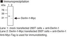 DERL1 / Derlin 1 Antibody