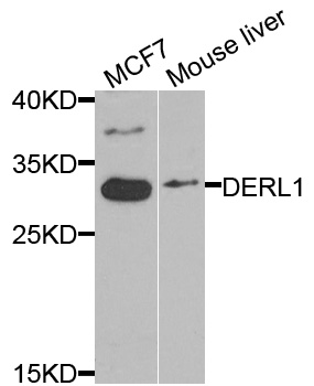 DERL1 / Derlin 1 Antibody - Western blot analysis of extracts of various cells.