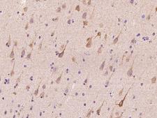 DERL1 / Derlin 1 Antibody - Immunochemical staining of human DERL1 in human brain with rabbit polyclonal antibody at 1:100 dilution, formalin-fixed paraffin embedded sections.