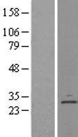 DERL1 / Derlin 1 Protein - Western validation with an anti-DDK antibody * L: Control HEK293 lysate R: Over-expression lysate