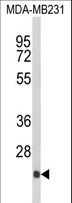DERL2 / Derlin-2 Antibody - Western blot of DERL2 Antibody in MDA-MB231 cell line lysates (35 ug/lane). DERL2 (arrow) was detected using the purified antibody.