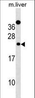 DERL2 / Derlin-2 Antibody - Mouse Derl2 Antibody western blot of mouse liver tissue lysates (35 ug/lane). The Derl2 antibody detected the Derl2 protein (arrow).