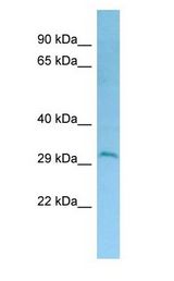 DERL2 / Derlin-2 Antibody - DERL2 / Derlin-2 antibody Western Blot of HCT15.  This image was taken for the unconjugated form of this product. Other forms have not been tested.