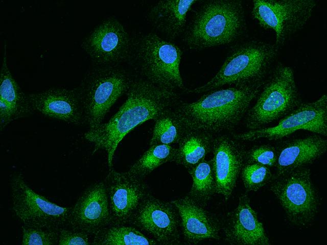 DERL2 / Derlin-2 Antibody - Immunofluorescence staining of DERL2 in U2OS cells. Cells were fixed with 4% PFA, permeabilzed with 0.1% Triton X-100 in PBS, blocked with 10% serum, and incubated with rabbit anti-Human DERL2 polyclonal antibody (dilution ratio 1:200) at 4°C overnight. Then cells were stained with the Alexa Fluor 488-conjugated Goat Anti-rabbit IgG secondary antibody (green) and counterstained with DAPI (blue). Positive staining was localized to Cytoplasm.