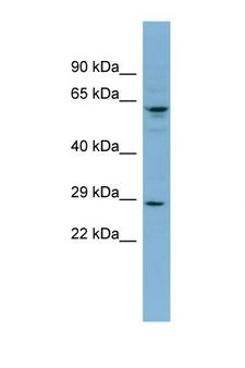 Derlin-3 / DERL3 Antibody - DERL3 antibody Western blot of 1 Cell lysate. Antibody concentration 1 ug/ml. This image was taken for the unconjugated form of this product. Other forms have not been tested.