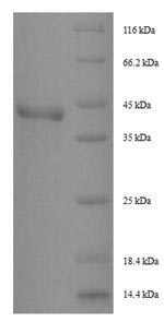 DERP1 Protein - (Tris-Glycine gel) Discontinuous SDS-PAGE (reduced) with 5% enrichment gel and 15% separation gel.