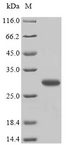 ELP5 Protein - (Tris-Glycine gel) Discontinuous SDS-PAGE (reduced) with 5% enrichment gel and 15% separation gel.