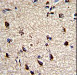 Dermatopontin / DPT Antibody - Formalin-fixed and paraffin-embedded human brain with DPT Antibody , which was peroxidase-conjugated to the secondary antibody, followed by DAB staining. This data demonstrates the use of this antibody for immunohistochemistry; clinical relevance has not been evaluated.
