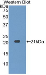 Dermatopontin / DPT Antibody - Western blot of recombinant Dermatopontin / DPT.  This image was taken for the unconjugated form of this product. Other forms have not been tested.