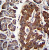Dermatopontin / DPT Antibody - DPT Antibody immunohistochemistry of formalin-fixed and paraffin-embedded human pancreas tissue followed by peroxidase-conjugated secondary antibody and DAB staining.