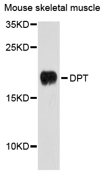 Dermatopontin / DPT Antibody - Western blot analysis of extracts of mouse skeletal muscle cells.