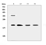 Dermatopontin / DPT Antibody - Western blot analysis of Dermatopontin using anti-Dermatopontin antibody. Electrophoresis was performed on a 5-20% SDS-PAGE gel at 70V (Stacking gel) / 90V (Resolving gel) for 2-3 hours. The sample well of each lane was loaded with 50ug of sample under reducing conditions. Lane 1: human Hela whole cell lysates,Lane 2: human placenta tissue lysates, Lane 3: rat lung tissue lysates, Lane 4: mouse lung tissue lysates. After Electrophoresis, proteins were transferred to a Nitrocellulose membrane at 150mA for 50-90 minutes. Blocked the membrane with 5% Non-fat Milk/ TBS for 1.5 hour at RT. The membrane was incubated with rabbit anti-Dermatopontin antigen affinity purified polyclonal antibody at 0.5 µg/mL overnight at 4°C, then washed with TBS-0.1% Tween 3 times with 5 minutes each and probed with a goat anti-rabbit IgG-HRP secondary antibody at a dilution of 1:10000 for 1.5 hour at RT. The signal is developed using an Enhanced Chemiluminescent detection (ECL) kit with Tanon 5200 system. A specific band was detected for Dermatopontin at approximately 20KD. The expected band size for Dermatopontin is at 24KD.