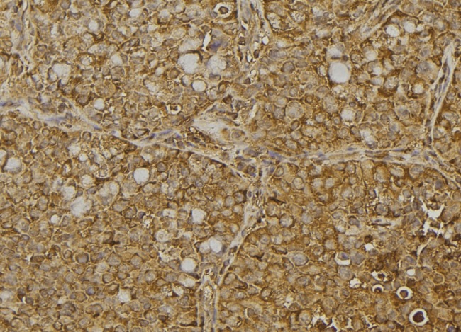 Dermatopontin / DPT Antibody - 1:100 staining human pancreas tissue by IHC-P. The sample was formaldehyde fixed and a heat mediated antigen retrieval step in citrate buffer was performed. The sample was then blocked and incubated with the antibody for 1.5 hours at 22°C. An HRP conjugated goat anti-rabbit antibody was used as the secondary.