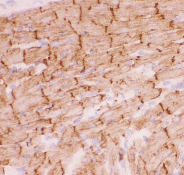 DES / Desmin Antibody - Desmin antibody IHC-frozen: Rat Cardiac Muscle Tissue.