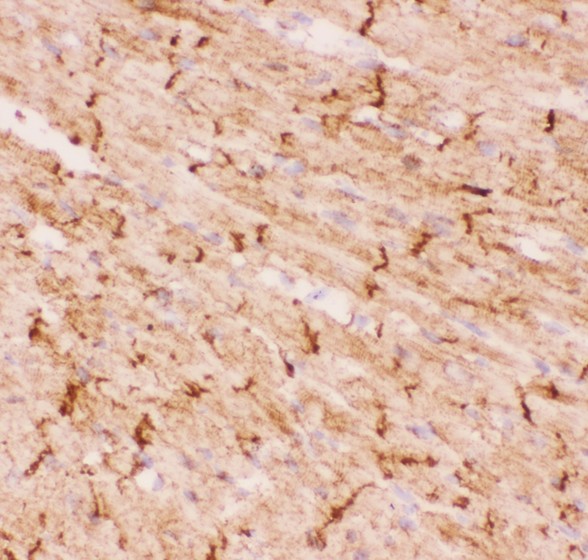 DES / Desmin Antibody - Desmin antibody IHC-frozen: Mouse Cardiac Muscle Tissue.