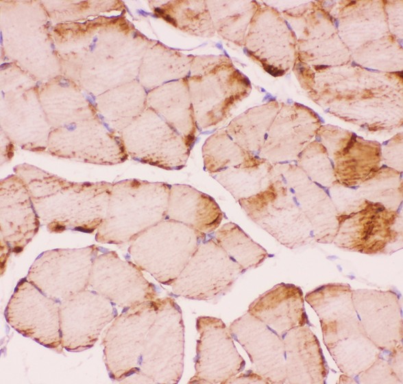 DES / Desmin Antibody - Desmin antibody IHC-paraffin: Mouse Skeletal Muscle Tissue.