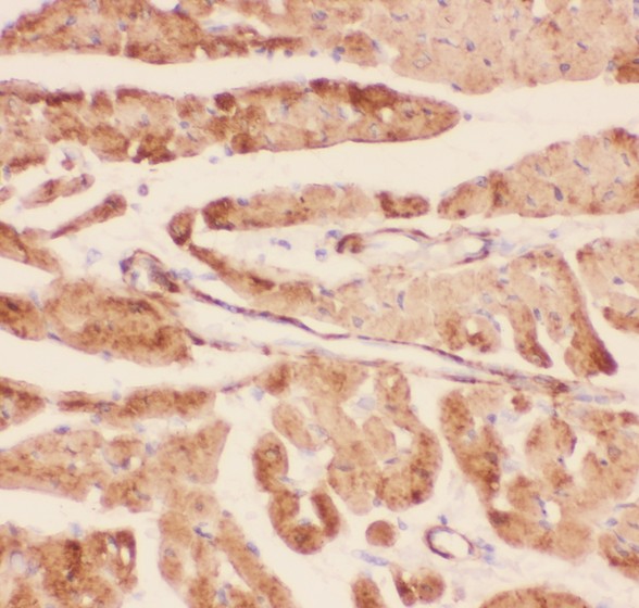 DES / Desmin Antibody - Desmin antibody IHC-paraffin: Rat Cardiac Muscle Tissue.