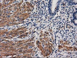 DES / Desmin Antibody - IHC of paraffin-embedded Human endometrium tissue using anti-DES mouse monoclonal antibody. (Heat-induced epitope retrieval by 10mM citric buffer, pH6.0, 100C for 10min).