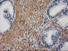 DES / Desmin Antibody - IHC of paraffin-embedded Human prostate tissue using anti-DES mouse monoclonal antibody. (Heat-induced epitope retrieval by 10mM citric buffer, pH6.0, 100C for 10min).
