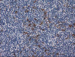 DES / Desmin Antibody - IHC of paraffin-embedded Human lymph node tissue using anti-DES mouse monoclonal antibody. (Heat-induced epitope retrieval by 10mM citric buffer, pH6.0, 100C for 10min).