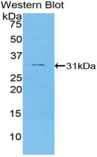 DES / Desmin Antibody - Western blot of recombinant DES / Desmin.  This image was taken for the unconjugated form of this product. Other forms have not been tested.