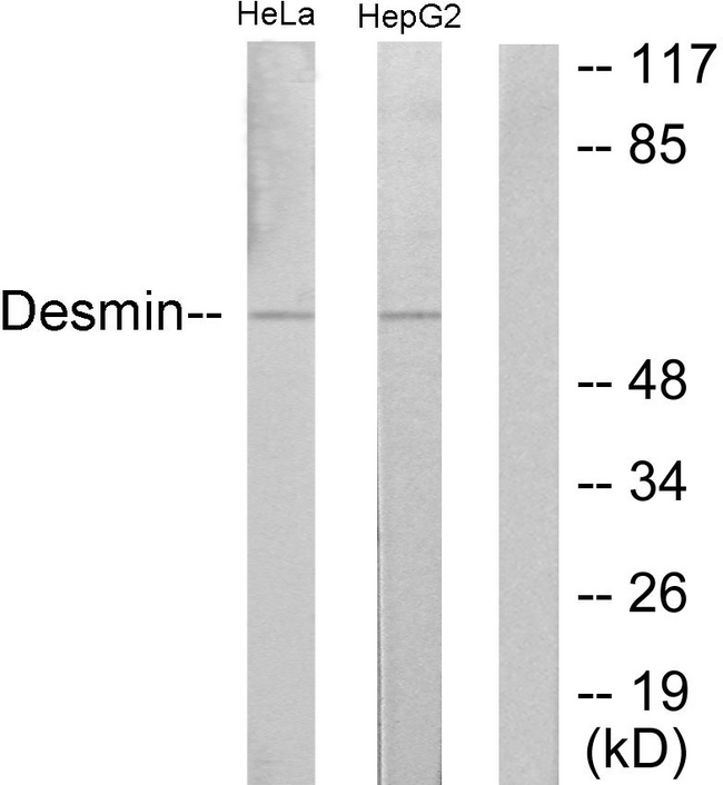 DES / Desmin Antibody - Western blot analysis of lysates from HeLa and HepG2 cells, using Desmin Antibody. The lane on the right is blocked with the synthesized peptide.