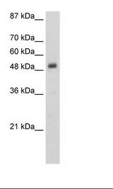 DES / Desmin Antibody - Jurkat Cell Lysate.  This image was taken for the unconjugated form of this product. Other forms have not been tested.