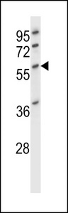 DES / Desmin Antibody - DES/Desmin (Muscle Cell Marker) Antibody western blot of HL-60 cell line lysates (35 ug/lane). The DES antibody detected the DES protein (arrow).