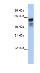 DES / Desmin Antibody - DES / Desmin antibody Western blot of Fetal Muscle lysate. This image was taken for the unconjugated form of this product. Other forms have not been tested.