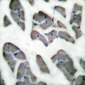 DES / Desmin Antibody - Immunohistochemistry analysis of paraffin-embedded human skeletal muscle tissue, using Desmin Antibody. The picture on the right is blocked with the synthesized peptide.
