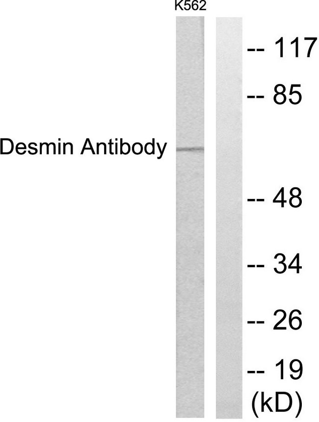 DES / Desmin Antibody - Western blot analysis of lysates from K562 cells, using Desmin Antibody. The lane on the right is blocked with the synthesized peptide.