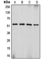 DES / Desmin Antibody - Western blot analysis of Desmin expression in Sol8 (A); HeLa (B); SJRH30 (C); PC12 (D) whole cell lysates.