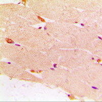 DES / Desmin Antibody - Immunohistochemical analysis of Desmin staining in human muscle formalin fixed paraffin embedded tissue section. The section was pre-treated using heat mediated antigen retrieval with sodium citrate buffer (pH 6.0). The section was then incubated with the antibody at room temperature and detected using an HRP conjugated compact polymer system. DAB was used as the chromogen. The section was then counterstained with hematoxylin and mounted with DPX.