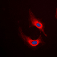 DES / Desmin Antibody - Immunofluorescent analysis of Desmin staining in HeLa cells. Formalin-fixed cells were permeabilized with 0.1% Triton X-100 in TBS for 5-10 minutes and blocked with 3% BSA-PBS for 30 minutes at room temperature. Cells were probed with the primary antibody in 3% BSA-PBS and incubated overnight at 4 C in a humidified chamber. Cells were washed with PBST and incubated with a DyLight 594-conjugated secondary antibody (red) in PBS at room temperature in the dark. DAPI was used to stain the cell nuclei (blue).