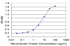 DES / Desmin Antibody - Detection limit for recombinant GST tagged DES is approximately 0.1 ng/ml as a capture antibody.