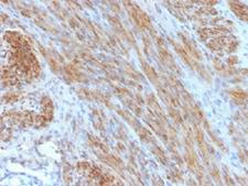 DES / Desmin Antibody - IHC testing of FFPE human uterus with Desmin antibody (clone DES/1711). Required HIER: boil tissue sections in 10mM citrate buffer, pH 6, for 10-20 min.