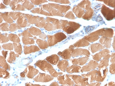 DES / Desmin Antibody - Formalin-fixed, paraffin-embedded human Skeletal Muscle stained with Desmin Rabbit Recombinant Monoclonal Antibody (DES/2960R).