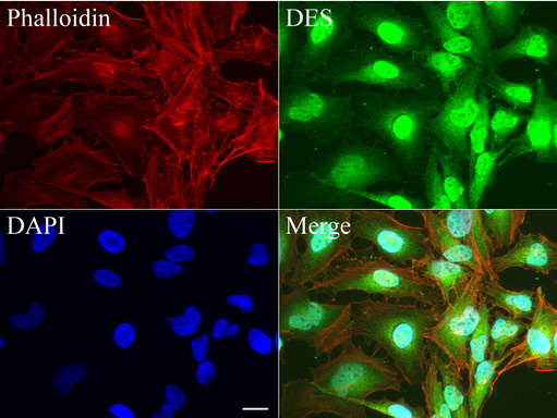DES / Desmin Antibody - Immunofluorescent staining of HeLa cells using anti-DES mouse monoclonal antibody  green, 1:50). Actin filaments were labeled with Alexa Fluor® 594 Phalloidin. (red), and nuclear with DAPI. (blue). Scale bar, 20µm.