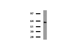 DES / Desmin Antibody - Western blot of human tissue lysates. (15ug) from colon. Diluation: 1:500.