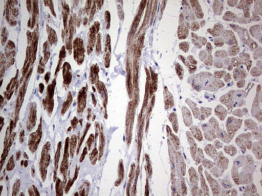 DES / Desmin Antibody - Immunohistochemical staining of paraffin-embedded Human adult heart tissue using anti-DES mouse monoclonal antibody.  heat-induced epitope retrieval by 1 mM EDTA in 10mM Tris, pH8.0, 120C for 3min)