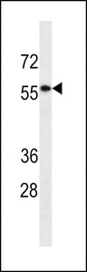 DES / Desmin Antibody - DESM Antibody western blot of CEM cell line lysates (35 ug/lane). The DESM antibody detected the DESM protein (arrow).
