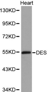 DES / Desmin Antibody - Western blot of DES pAb in extracts from mouse heart tissues.