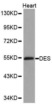 DES / Desmin Antibody - Western blot analysis of extracts of mouse heart, using DES antibody. The secondary antibody used was an HRP Goat Anti-Rabbit IgG (H+L) at 1:10000 dilution. Lysates were loaded 25ug per lane and 3% nonfat dry milk in TBST was used for blocking.