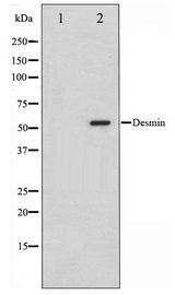 DES / Desmin Antibody - Western blot of HeLa cell lysate using Desmin Antibody